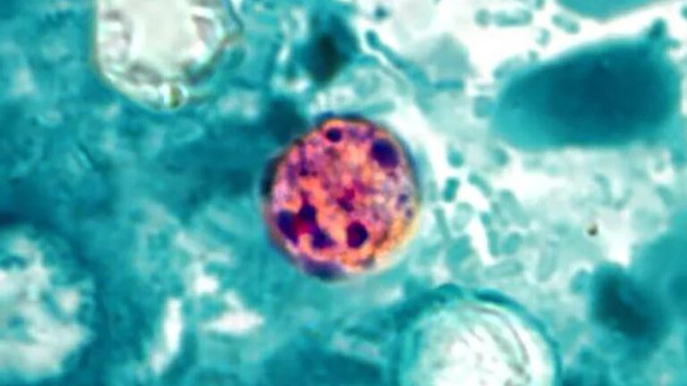 Explosive Diarrhea Is Surging Across The US Right Now : ScienceAlert